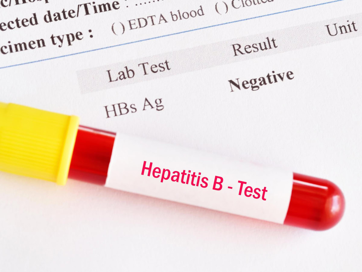 Καινοτομία στην εξέταση αίματος για την ηπατίτιδα Β